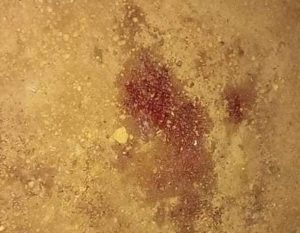 Insécurité : des malfrats tirent sur un jeune à Kaporo-rails et emporte son argent