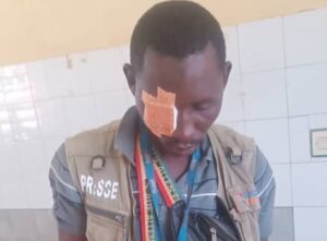 Agression d’un journaliste à Sigui: L’Urtelgui condamne et exige des comptes
